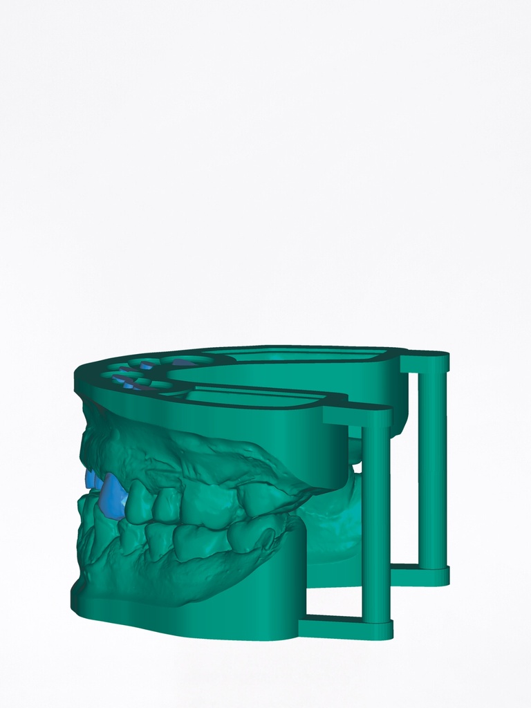 DentalCAD - Modulo Model Creator Flex