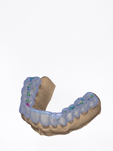 DentalCAD - Modulo Bite Splint