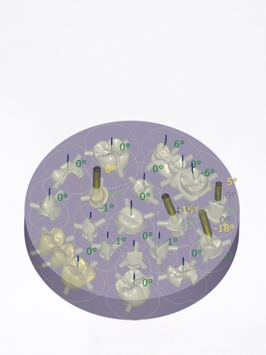 DentalCAD - Modulo Nesting