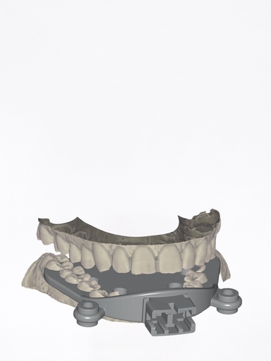 DentalCAD - Modulo Jaw Motion Import Flex